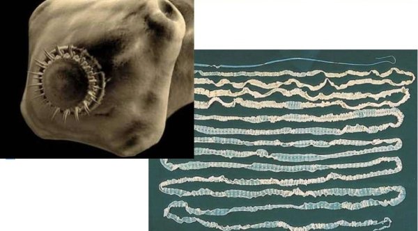 Цистицеркоз бычий цепень