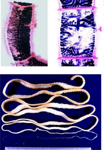 Плоские черви ленточные бычий цепень