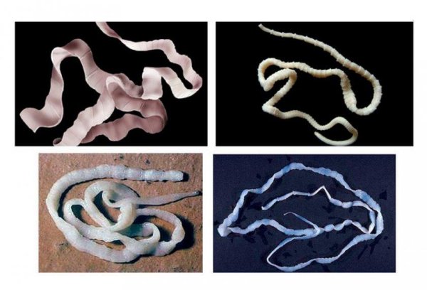 Тениаринхоз бычий цепень