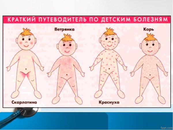 Внезапная экзантема (розеола).