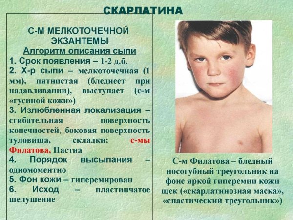 Скарлатина мелкоточечная сыпь