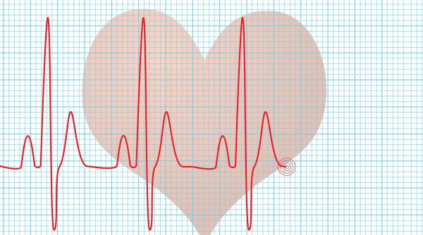 Кардиограмма сердца