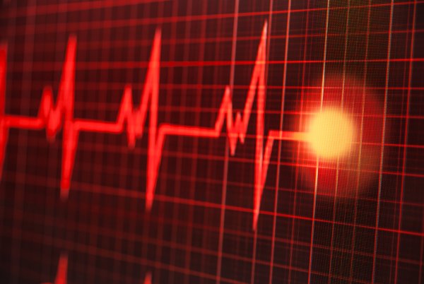 Пульс сердца