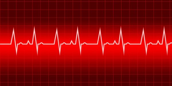 Сердечная кардиограмма