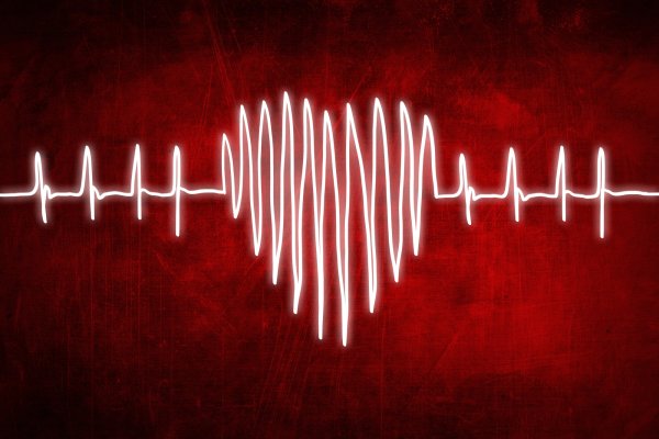 Бешеный пульс