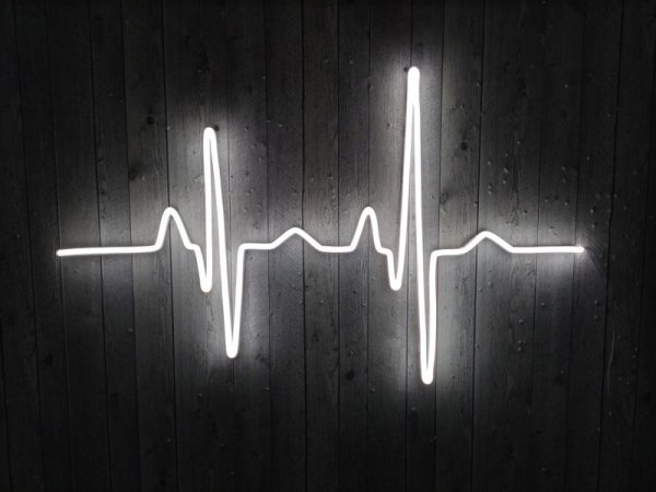 Кардиограмма сердца