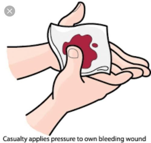 Артериальное кровотечение