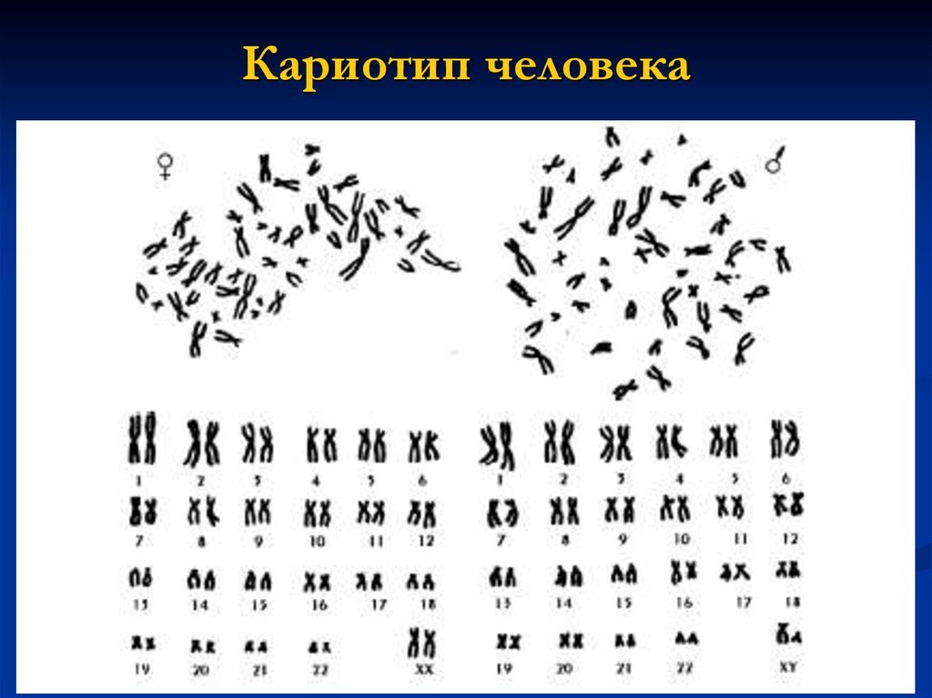 Кариотип человека определяют. Метафазная пластинка человека мужской кариотип. Идиограмма кариотипа человека. Кариотип набор хромосом 2n2c. Хромосомная карта кариотип.