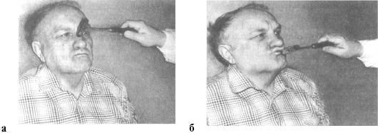 Схема рефлекторной дуги мигательного рефлекса