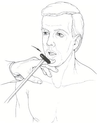 Маринеску Радовичи