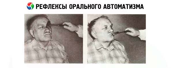 Рефлекторная дуга миндального рефлекса