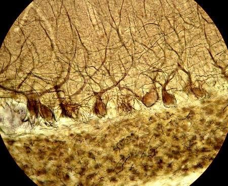 Кора больших полушарий головного мозга гистология