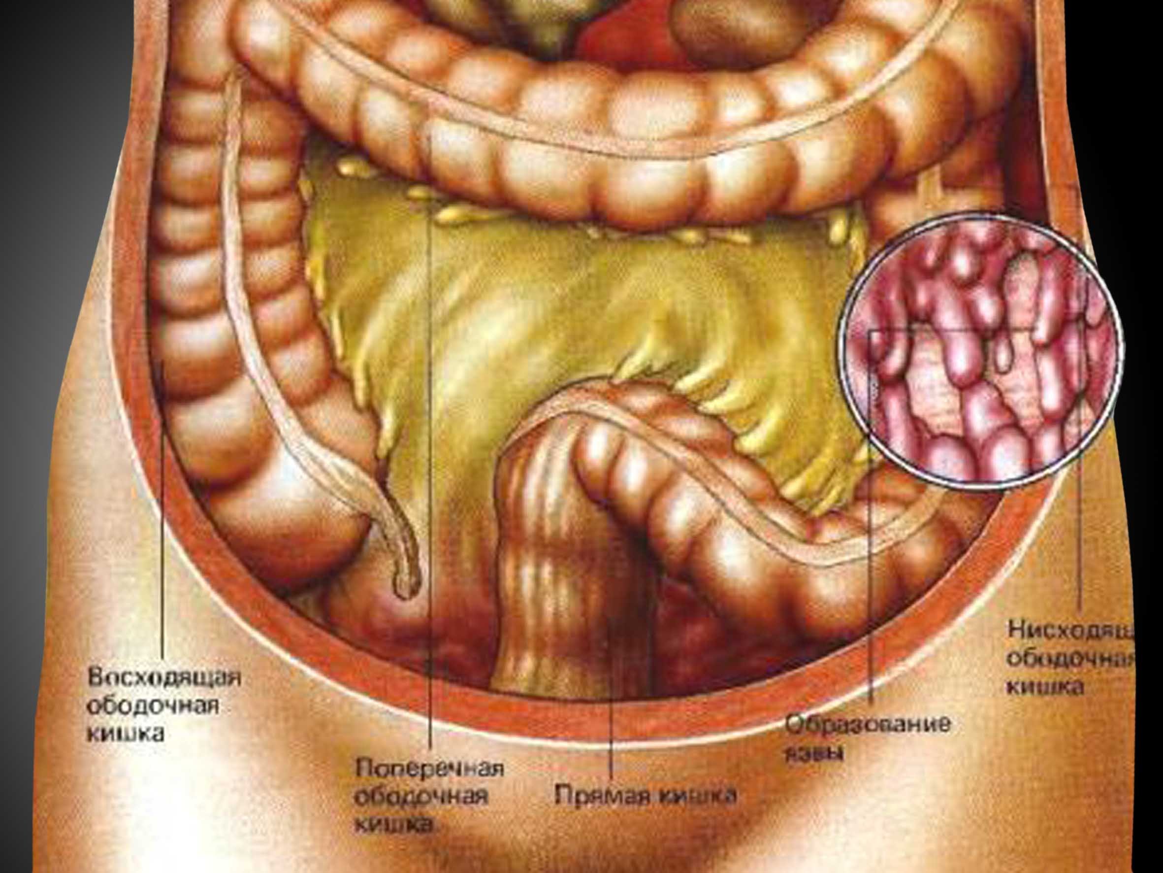 Кишка с правой стороны. Ободочная толстая кишка анатомия. Толстая кишка анатомия расположение. Кишечник человека толстая и прямая кишка. Кишечник толстая кишка анатомия.