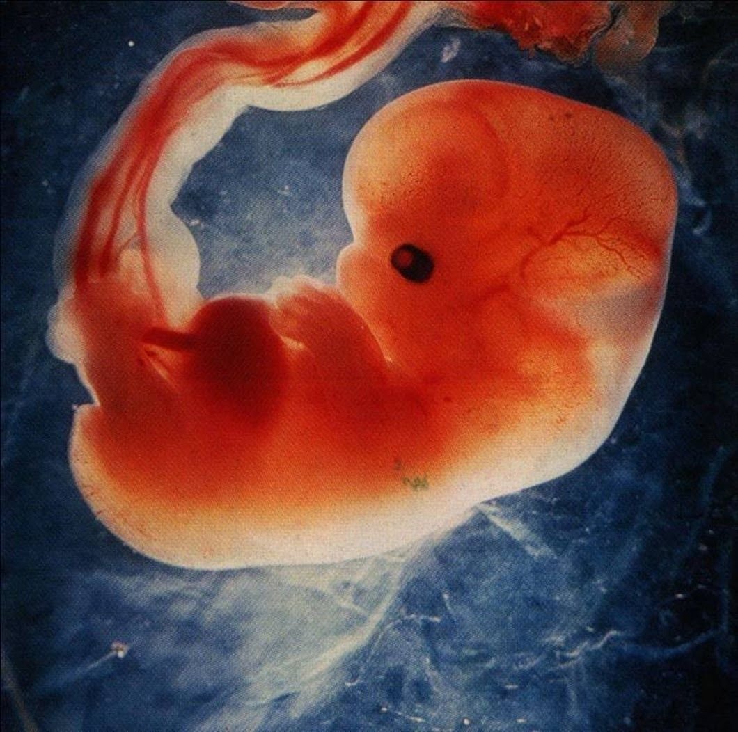 Пятая неделя ребенку. Эмбрион на 5.5 неделе беременности. Эмбрион на 6 неделе беременности. Эмбрион в 5 недели беременнос.