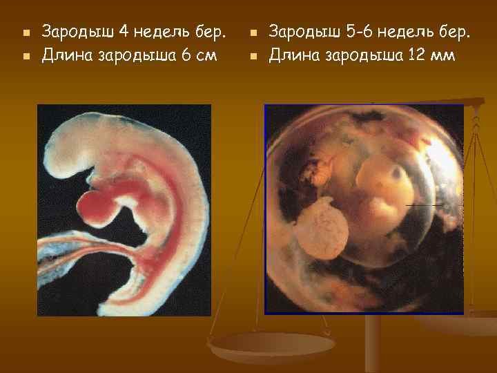 6 недель от зачатия