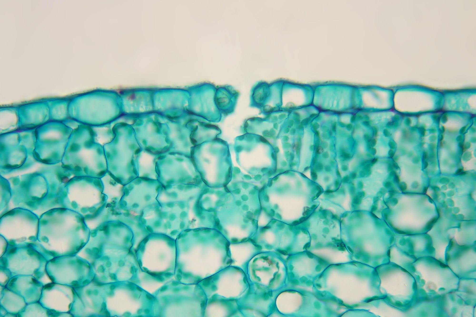 Клетка покровной ткани листа. Фотосинтезирующая ткань листа под микроскопом. Ткань клетки листа элодеи. Губчатая ткань листа под микроскопом. Препарат столбчатой ткани листа под микроскопом.