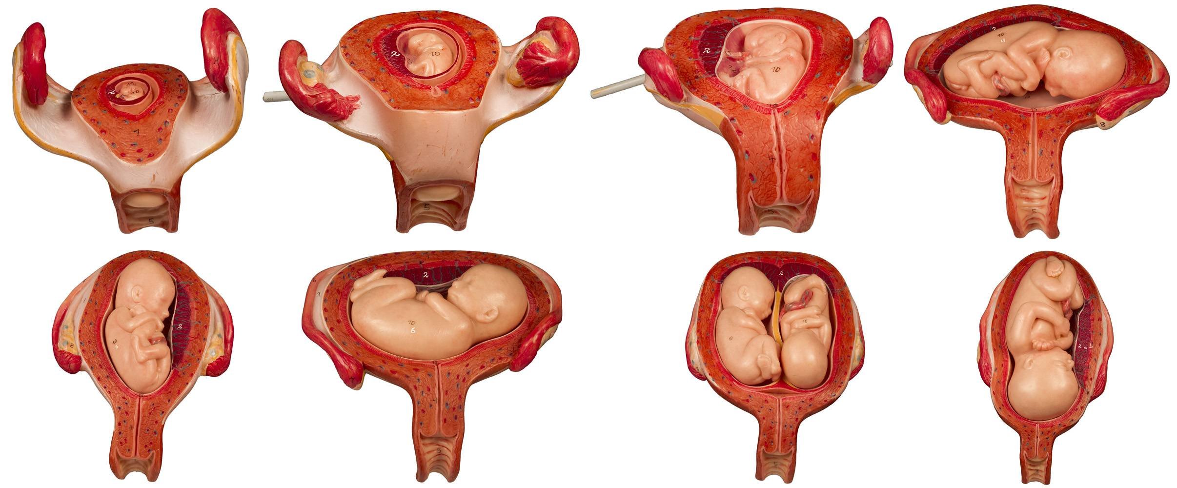 Nasiax1 - kanotie.com