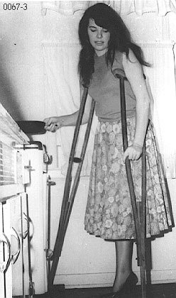 Женщины ампути ретро на костылях