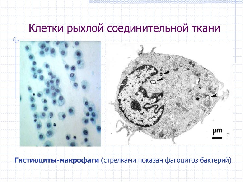 Макрофаги в тканях. Гистиоциты соединительной ткани. Макрофаги клетки гистиоциты. Клетки фагоциты рыхлосоединительной ткани. Гистиоциты в рыхлой соединительной ткани.