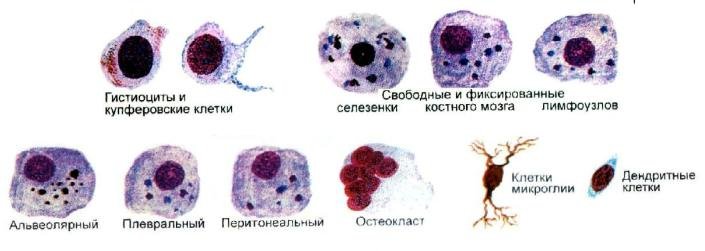 Атипичные клетки в цитологии что это. Лейкоциты, гистиоциты, макрофаги. Макрофаги гистология. Гистиоциты в цитологии. Клетки в плевральной жидкости микроскопия.