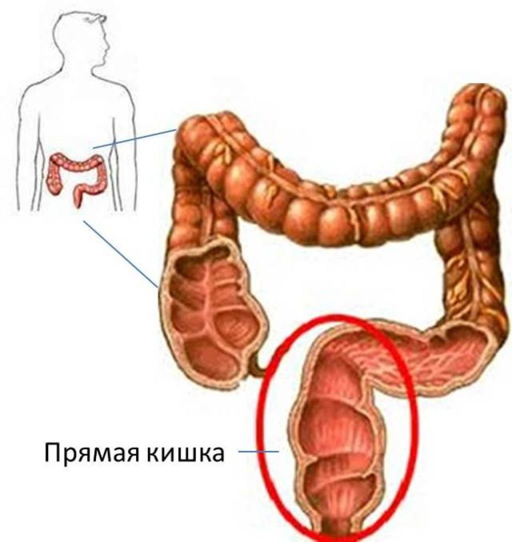 Удлиненная сигмовидная. Прямая кишка анатомия человека. Прямая кишка анатомия у мужчин Размеры. Строение прямой кишки и заднего прохода у мужчин. Анатомия толстой кишки и прямой кишки.