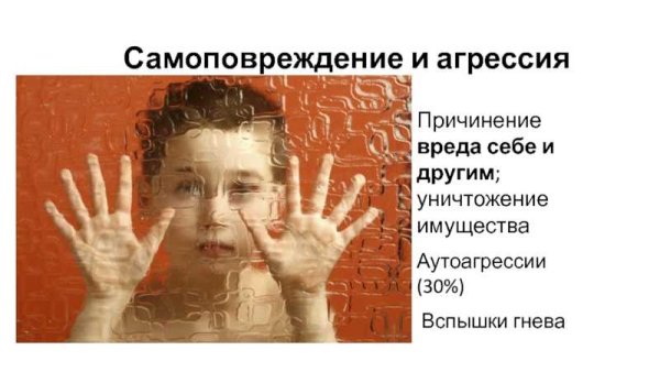 Агрессия у детей с рас