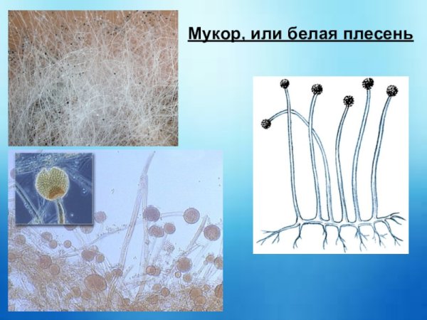 Зигомицеты ризопус