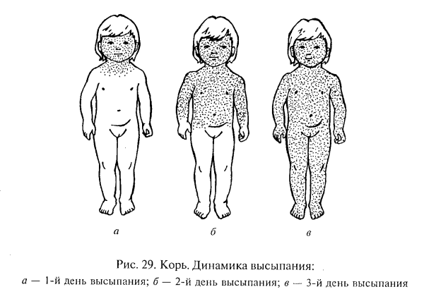 Герпетический вирус розеола