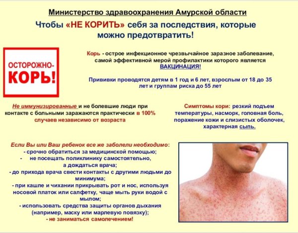 Корь профилактика заболевания