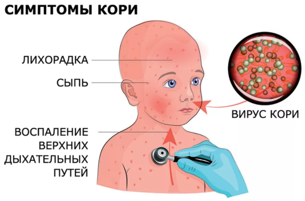 Инфекционные заболевания у детей