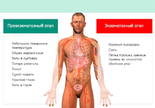 Коревая краснуха иммунитет