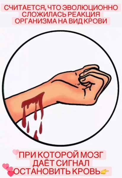 Наружное кровотечение