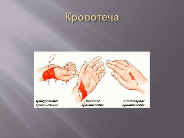 Венозное кровотечение рисунок