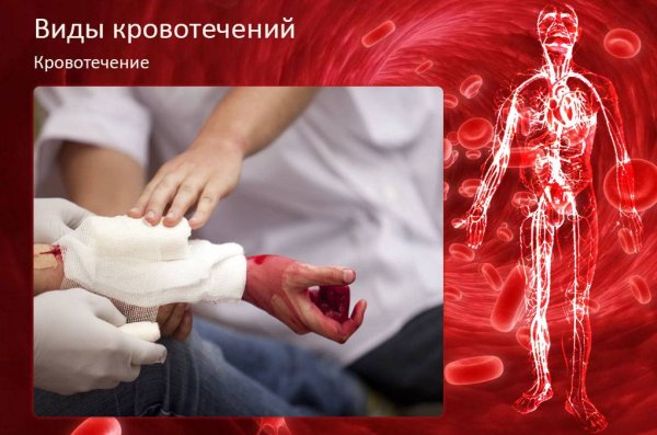 Медицина кровотечение