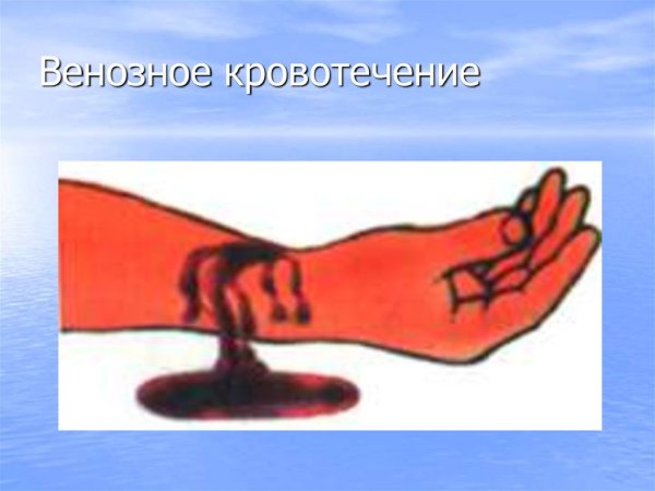 Капиллярное кровотечение