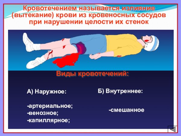 Остановку кровотечения (ранение в области предплечья)