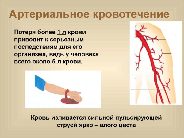 Наружные кровотечения