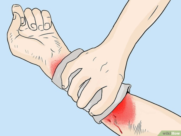 Виеощное кровпгтечение