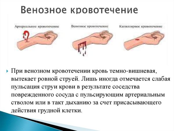 Венозное кровотечение рисунок