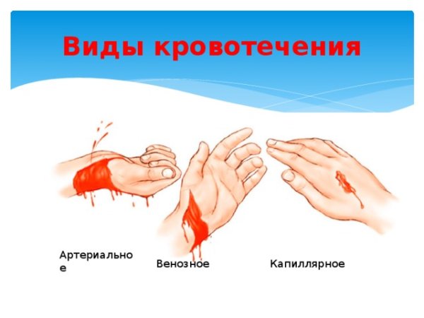 Порядок оказания 1 медицинской помощи при ранениях