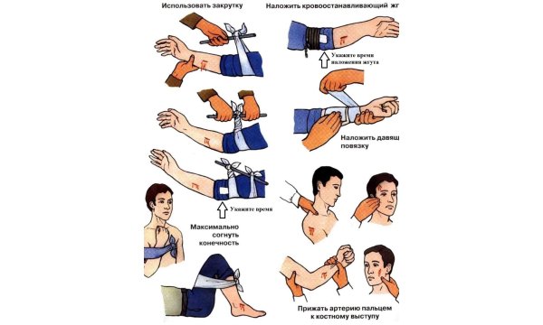 Алгоритм оказания неотложной помощи при наружном кровотечении