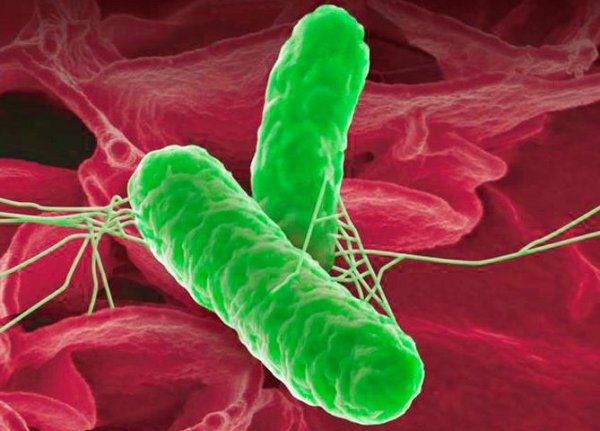 Дизентерии (Shigella dysenteriae)