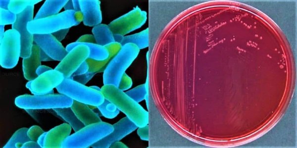 Шигелла Флекснера