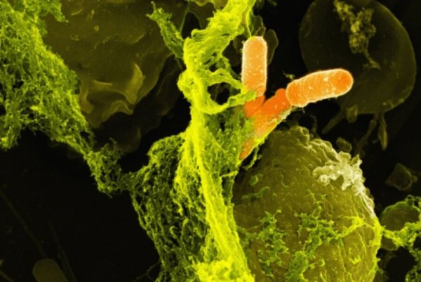 Шигеллы токсинообразование