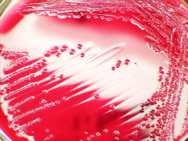 Shigella dysenteriae (шигелла дизентерия)