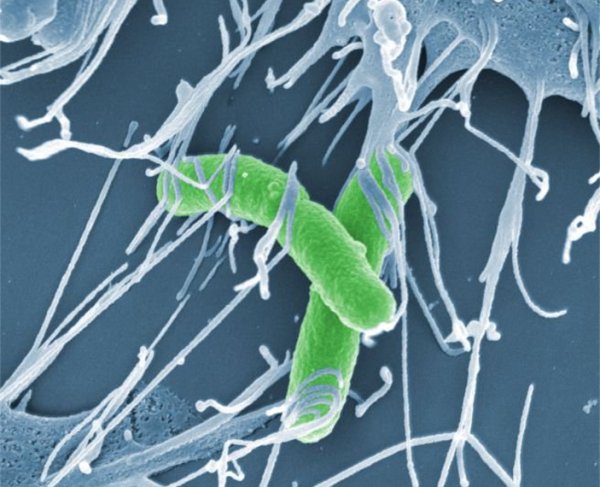 Шигелла Флекснера