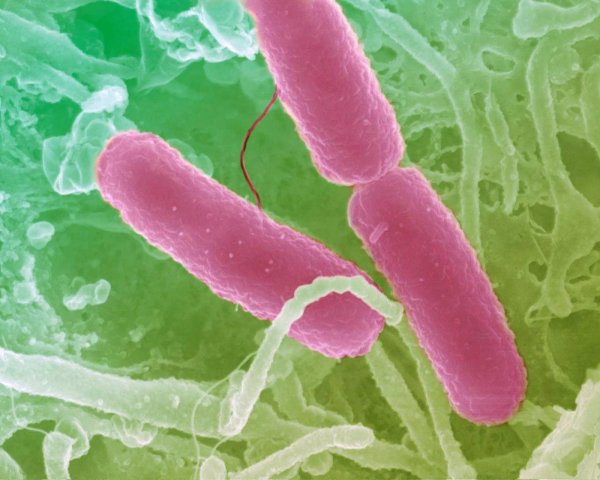 Возбудитель дизентерии Shigella dysenteriae