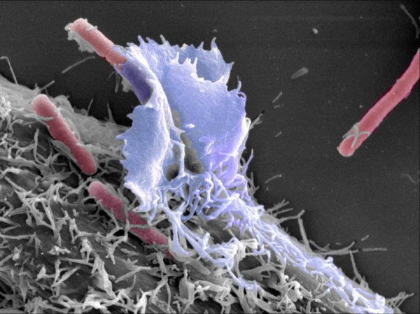 Бактерия шигелла