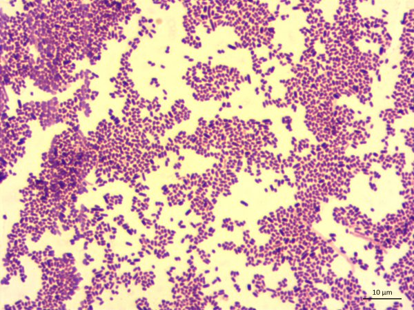 Shigella dysenteriae микроскопия