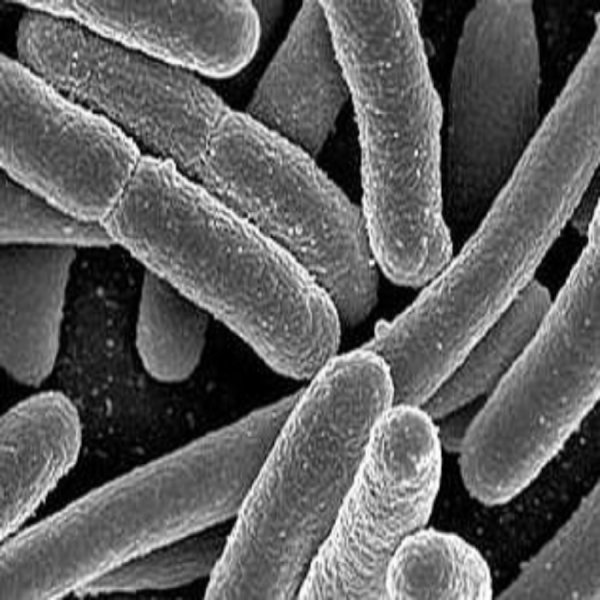 Возбудитель дизентерии Shigella dysenteriae